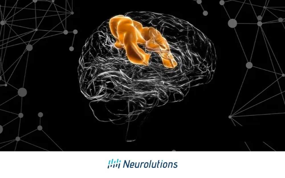 The Effects of Stroke on the Motor Cortex and How It Impacts Movement