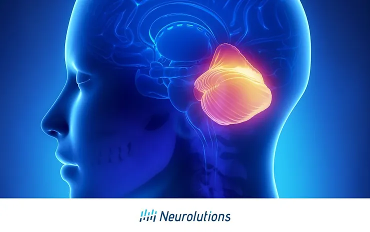 Guide to Cerebellum Stroke — Cauѕes, After Effects, and Recoveгy